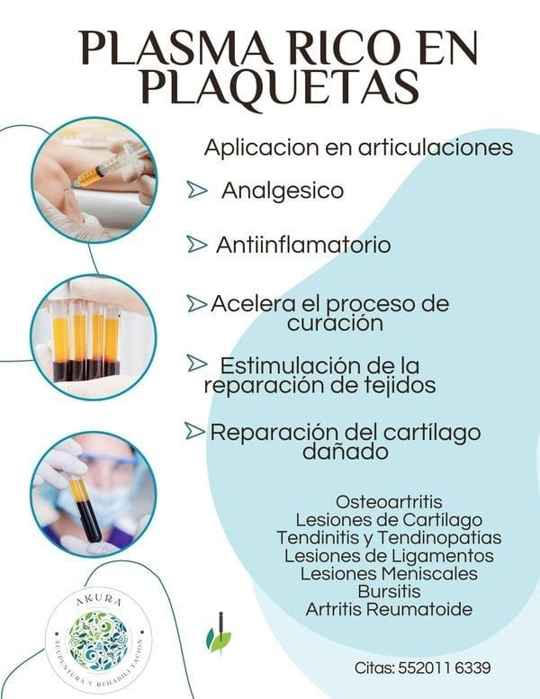 Plasma rico en plaquetas