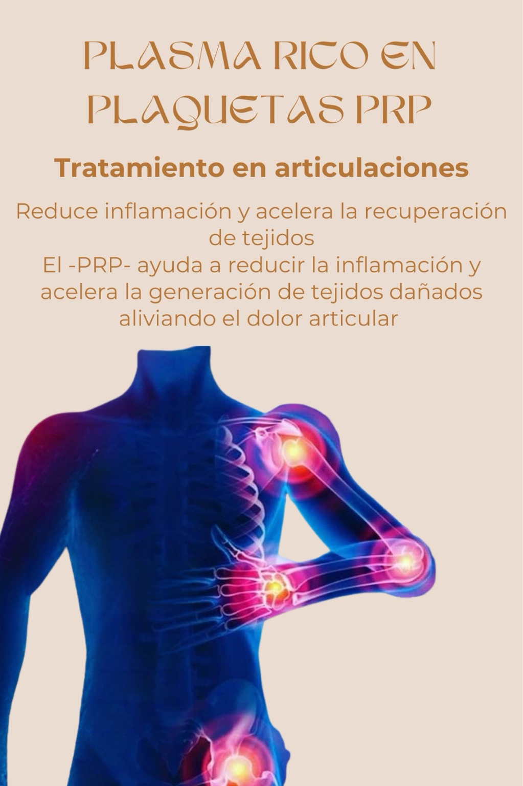 PRP articulaciones